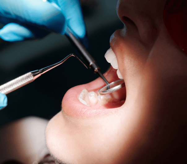 Imagem Ilustrativa da Periodontia